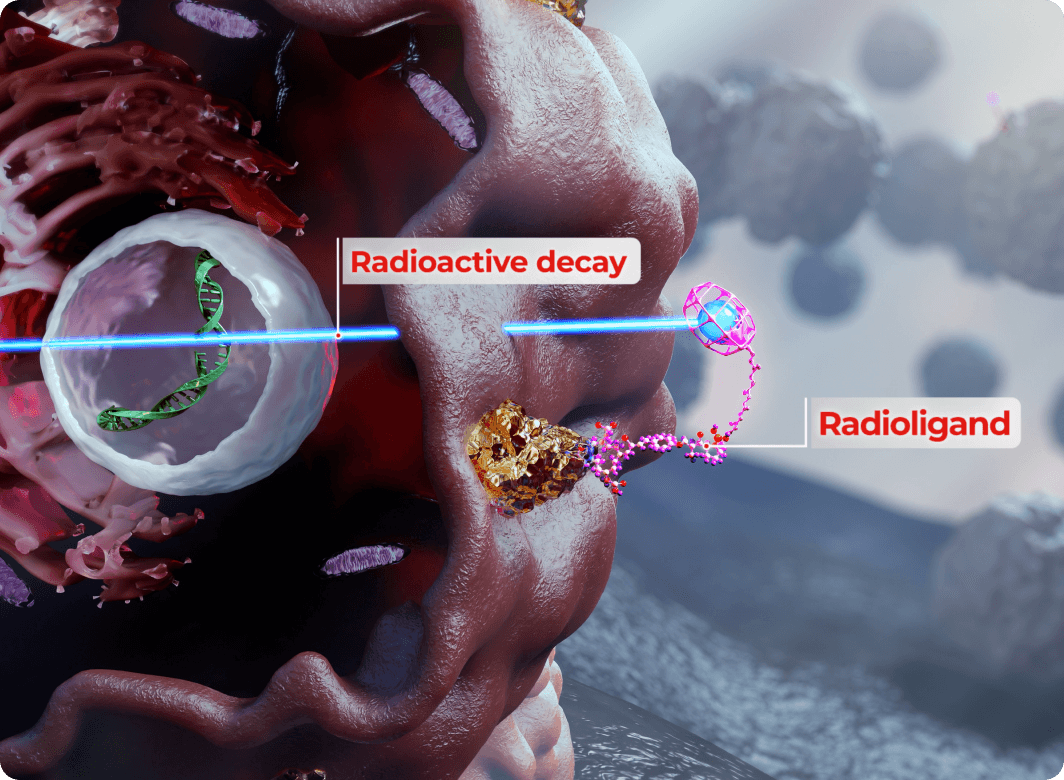 Radioligand Therapy image
